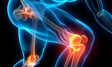 Top 5 Natural Ingredients for Joint Health (and Why They Work)